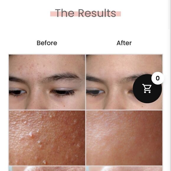 Pure zone nano facial steamer /humidifier towel warmer - Picture 6 of 6